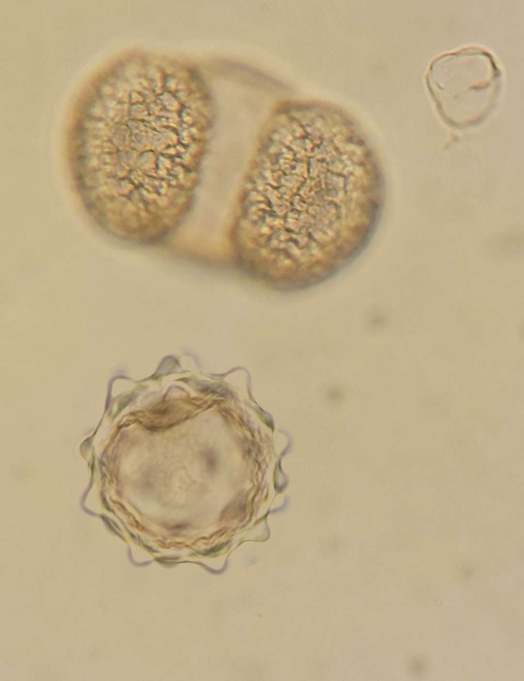 Pollen from Langman, with a pine grain at the top and an Ambrosia (ragweed) grain at the bottom - Photo by Lily E.